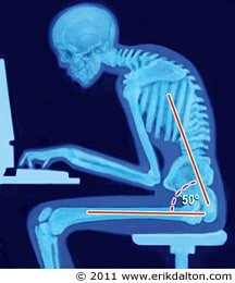 Can Bad Spinal Health And Poor Posture Contribute To Disease Processes Pinnacle Chiropractic Highlands Ranch, CO